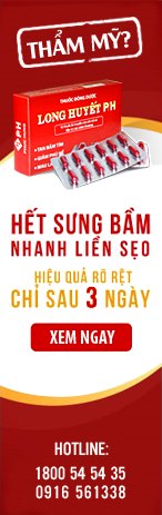 Quảng cáo